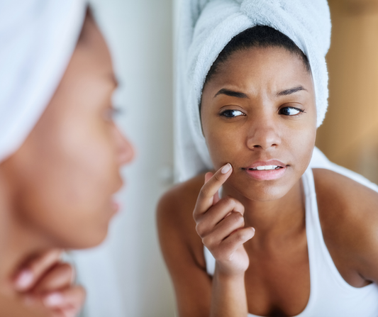 Why Hotel Pillowcases Trigger Breakouts